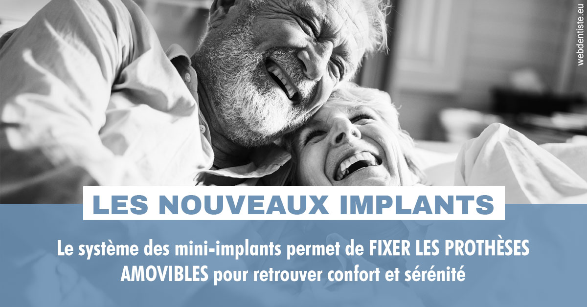 https://dr-sebag-leon.chirurgiens-dentistes.fr/Les nouveaux implants 2
