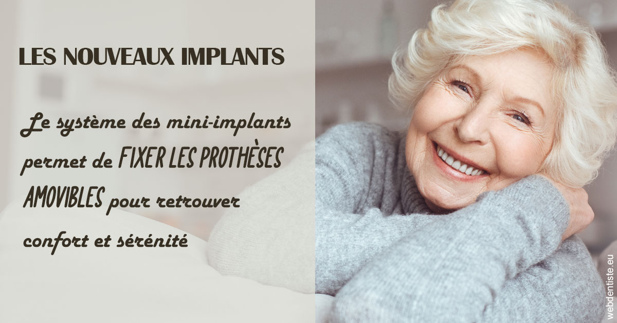 https://dr-sebag-leon.chirurgiens-dentistes.fr/Les nouveaux implants 1