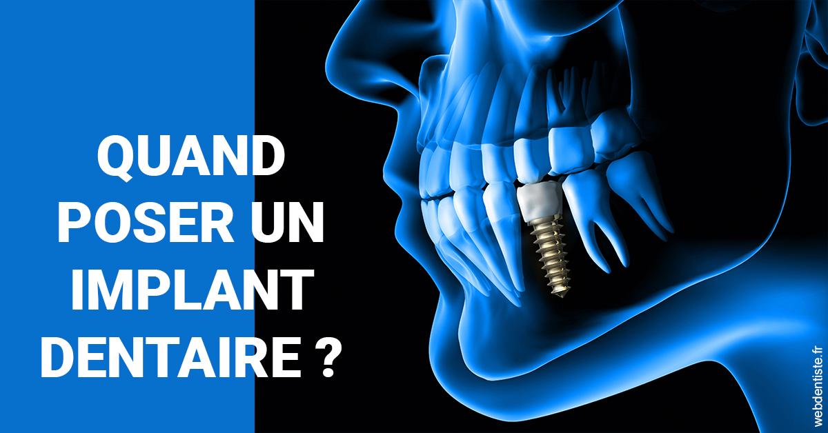 https://dr-sebag-leon.chirurgiens-dentistes.fr/Les implants 1