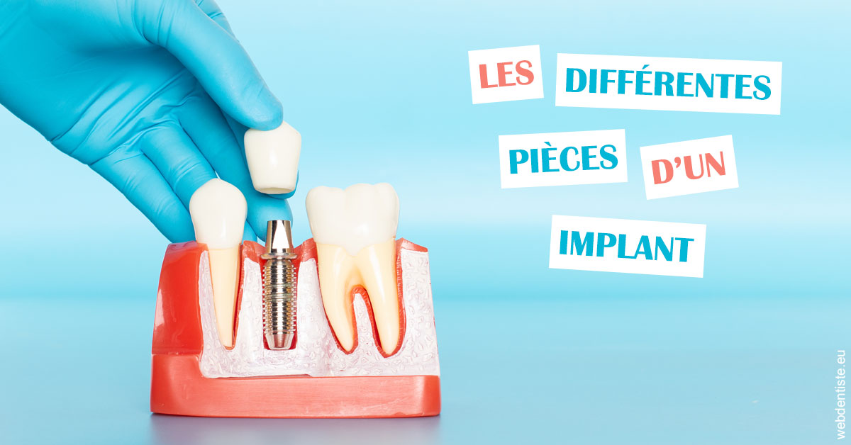 https://dr-sebag-leon.chirurgiens-dentistes.fr/Les différentes pièces d’un implant 2