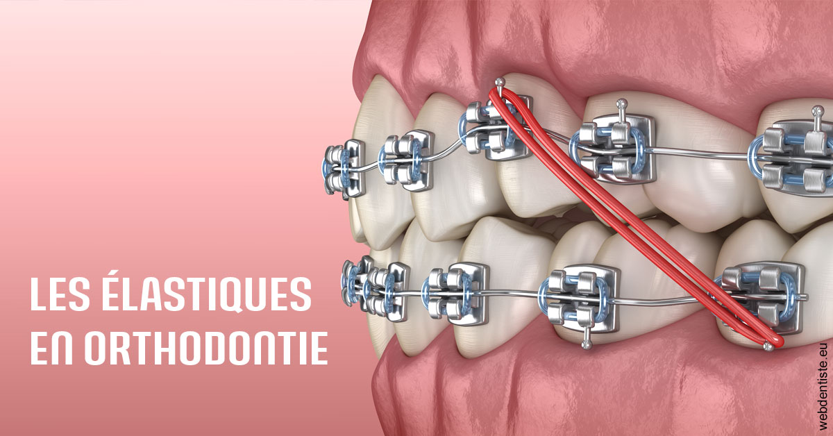 https://dr-sebag-leon.chirurgiens-dentistes.fr/Elastiques orthodontie 2