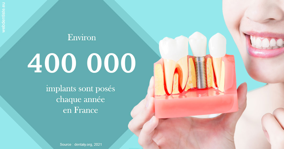 https://dr-sebag-leon.chirurgiens-dentistes.fr/Pose d'implants en France 2